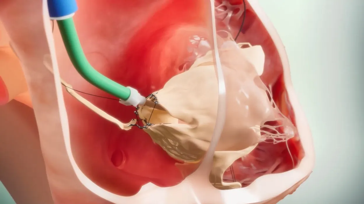 Project Showcase Video 3