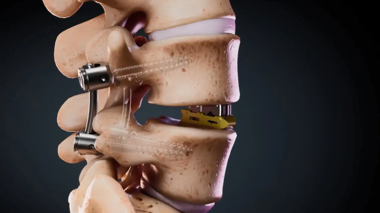 Project Showcase Video 7