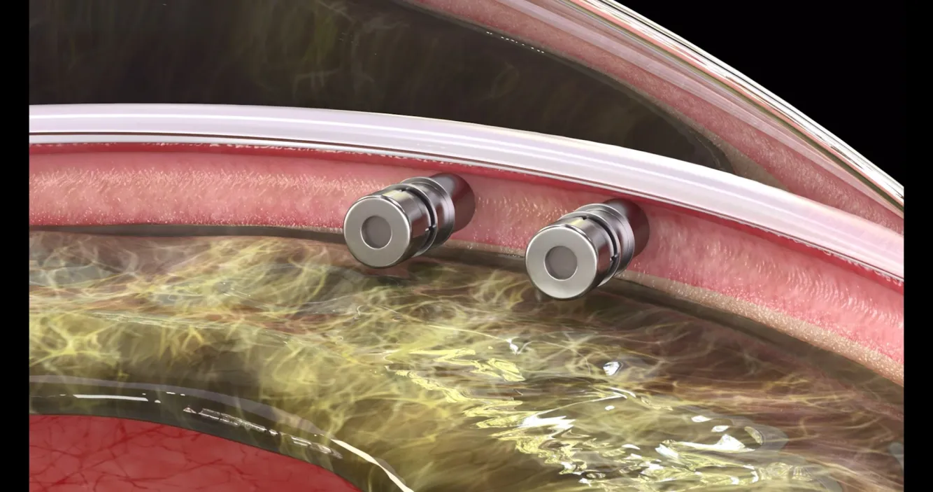 Project Showcase Video 8