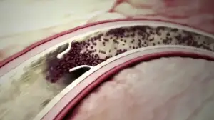 Medical Device Animation