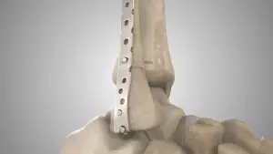 Medical Animation